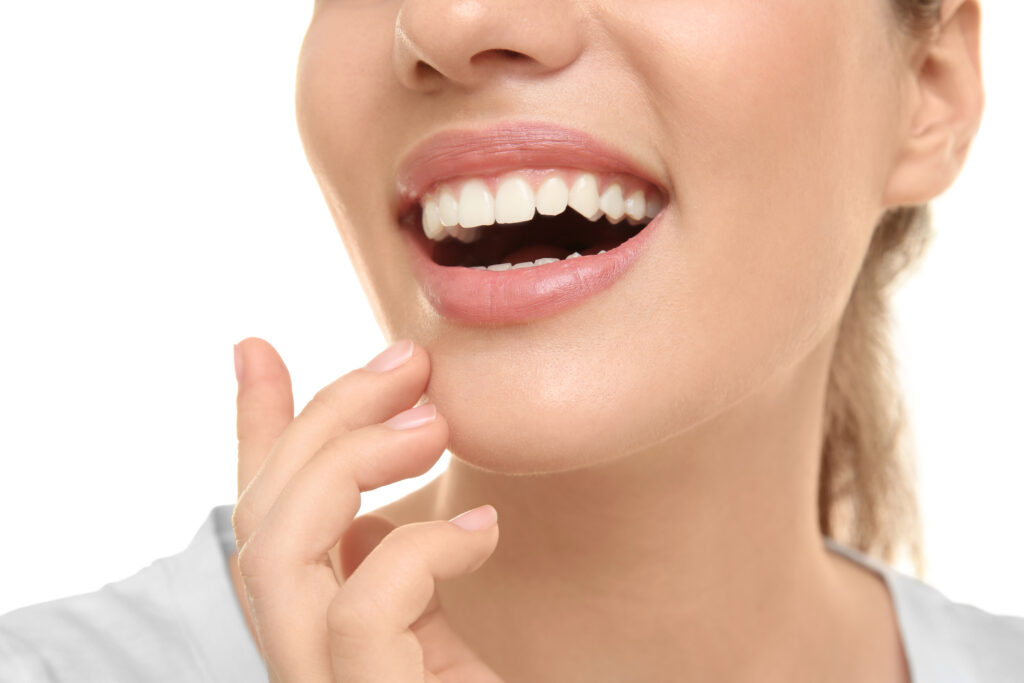 dental bonding white teeth