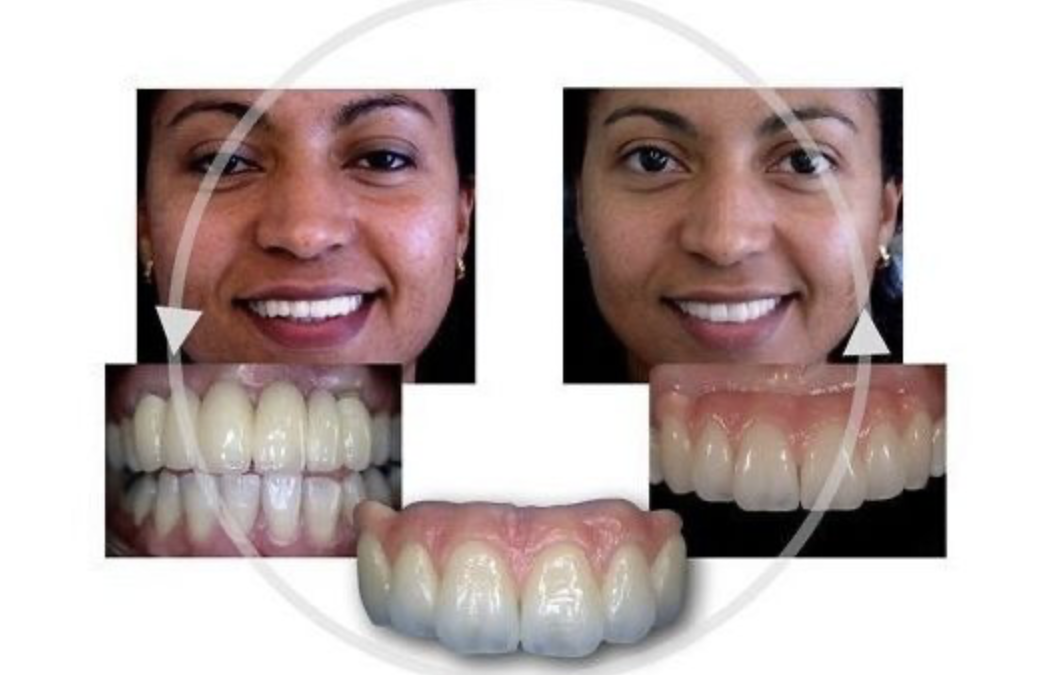 Digital Smile Design®: Test Driving a New Smile