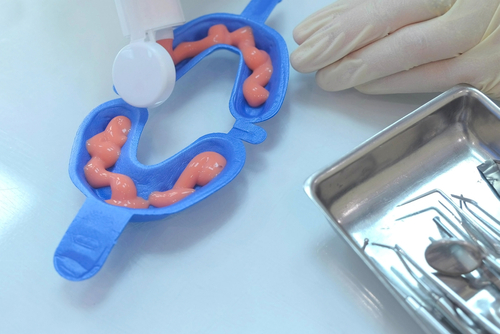 Dentist,Is,Putting,Fluoride,Gel,In,Mouth,Guard,In,